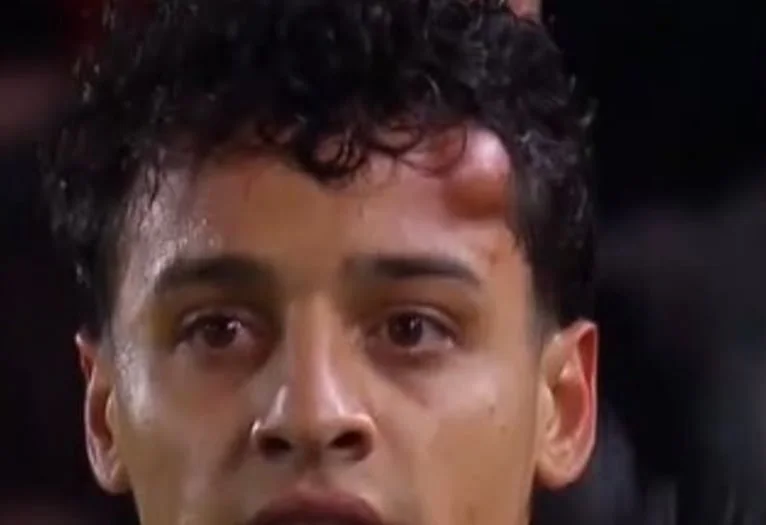 El duro golpe que obligó a Tiago Palacios a salir de la cancha en el partido de Estudiantes